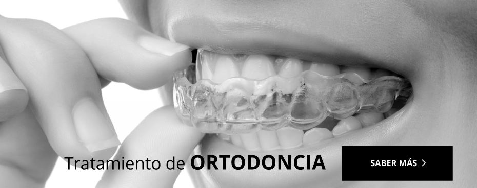 ortodoncia ansoain